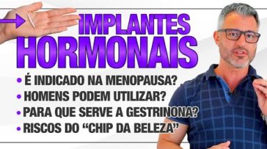 IMPLANTE HORMONAL é perigoso? Quando é indicado fazer?  🤔⚠