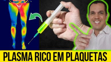 PLASMA RICO EM PLAQUETAS (PRP) - REGENERAÇÃO DAS ARTICULAÇÕES