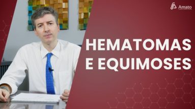 Roxos nas pernas? Hematomas, Equimoses e Petéquias