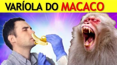 VARÍOLA DO MACACO - Quais Os Sinais da INFECÇÃO? - Dr. Gabriel Azzini