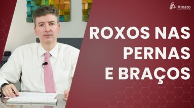 Roxos nas Pernas e Braços