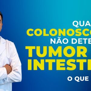 Colonoscopia FALHOU na detecção do Tumor Intestinal. Por quê? Dr. Fernando Lemos - Planeta Intestino