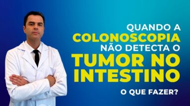 Colonoscopia FALHOU na detecção do Tumor Intestinal. Por quê? Dr. Fernando Lemos - Planeta Intestino