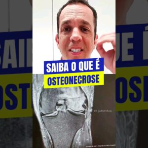 No vídeo de hoje explico sobre um caso de osteonecrose, ou seja, necrose no osso.