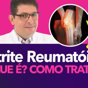 O que é a Artrite reumatoide, como tratar? | Dr Juliano Teles