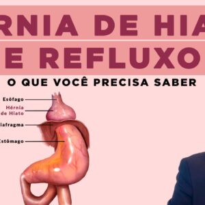 Hérnia de Hiato e Refluxo! O que é e qual o tratamento? Dr. Fernando Lemos, Coloproctologista.