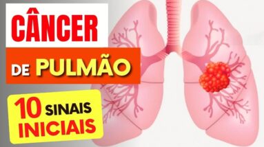 10 SINAIS de Alerta para CÂNCER de PULMÃO que Todos Deveriam Saber