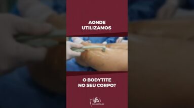 Aonde Utilizamos o Bodytite no seu Corpo?