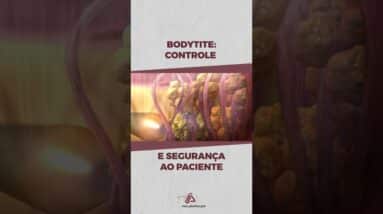 Bodytite: Controle e Segurança ao Paciente