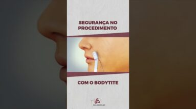 Segurança no Procedimento com o Bodytite