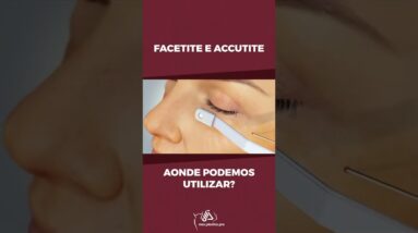 Facetite e Accutite, Aonde Podemos Utilizar?