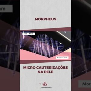 Morpheus - Micro Cauterizações na Pele