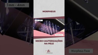 Morpheus - Micro Cauterizações na Pele