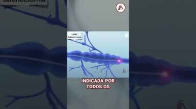 Recuperação Rápida após Cirurgia de Varizes com Laser